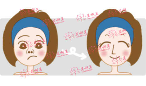 鼻子填充玻尿酸常见问题解答：多少钱、几只才够、维持多久等都有回答！