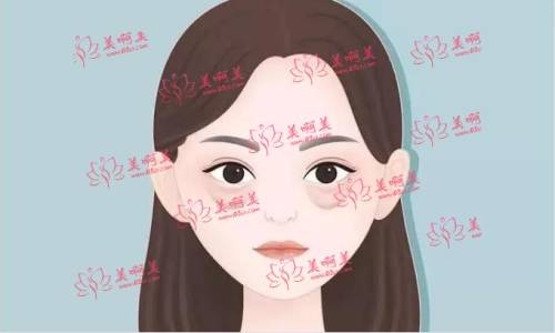 广州健丽医美正规吗？祛眼袋技术怎么样？医生介绍+地址