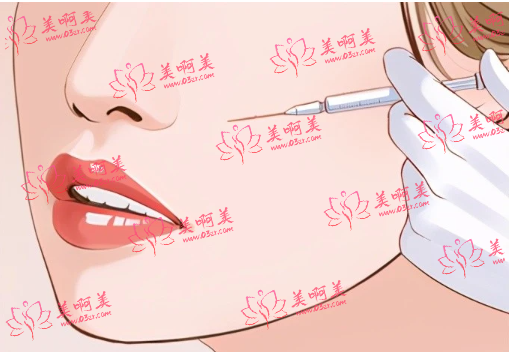 轮廓固定就等于填充吗?一览轮廓固定与填充的区别与联系! 轮廓固定就等于填充吗?一览轮廓固定与填充的区别与联系!