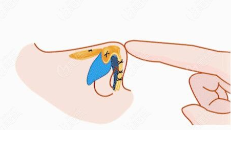 速览北京304医院美容整形科简介！医院实力、整形案例、价格详情全知晓！