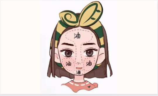 油性皮肤应该怎样选择护肤品?先来看看油皮的特点吧! 油性皮肤应该怎样选择护肤品?先来看看油皮的特点吧!