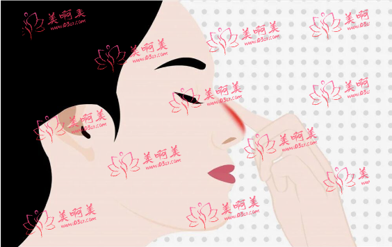超肋鼻30000价格合理吗？影响费用的因素有哪些？维持时间多久？