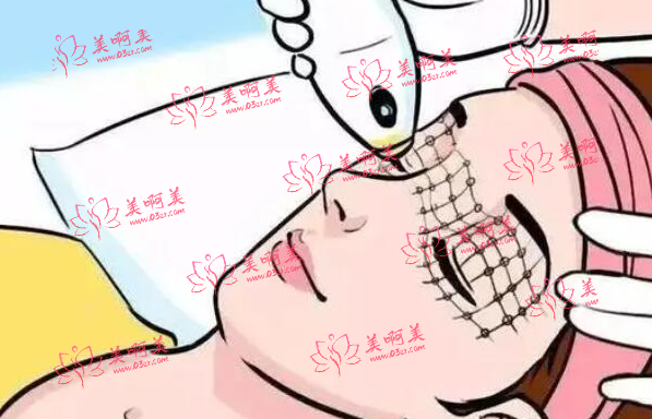 光子嫩肤价格一般是多少？盘点光子嫩肤的优缺点！