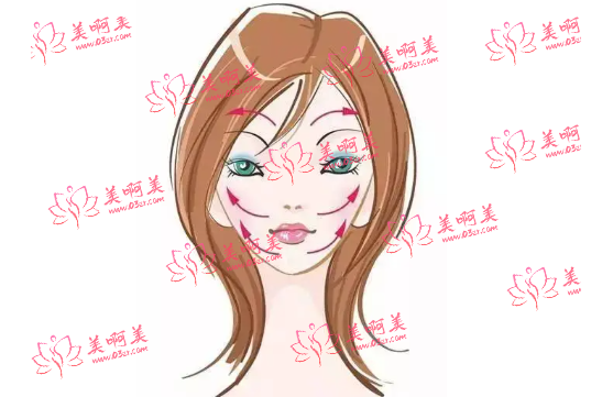 面部提拉紧致收费贵不贵？哪些人群适合做这个项目？