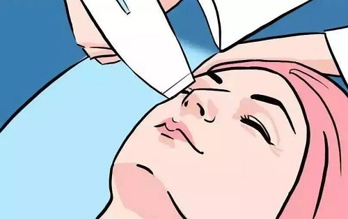 广东美恩热玛吉有什么效果，经典热玛吉案例分享！