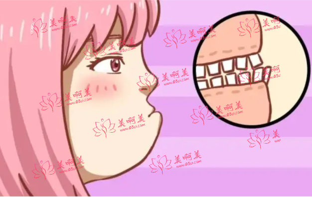 上海九院王国民医生介绍，正颌手术案例分享，看看手术前后对比！