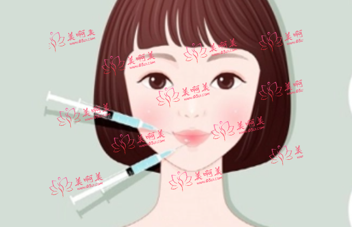 宁波玻尿酸丰唇整形医院哪家好？艺星、薇琳、壹加壹都很不错！