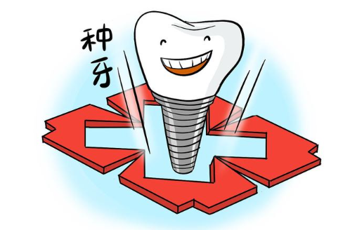 福州种植牙价格收费情况一览：国产、进口的种植牙价格收费一览！