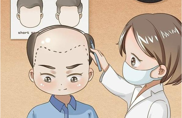 长沙艺星可以做植发项目吗？当然可以，实力还很在线！