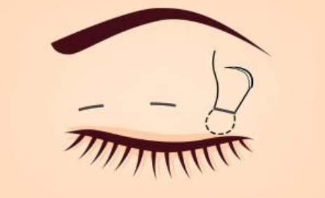 常州曙光美容医院口碑好不好?还有收费情况、特色项目分享! 常州曙光美容医院口碑好不好?还有收费情况、特色项目分享!