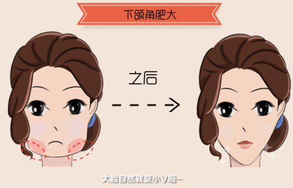 深圳八大处整形项目收费表全网公开，含各种项目，预约方式分享！