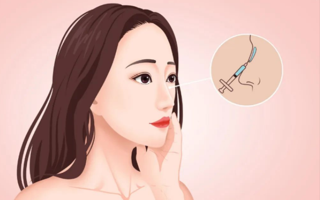 隆鼻手术有哪些种类，不同的手术方式有什么区别？一键了解！