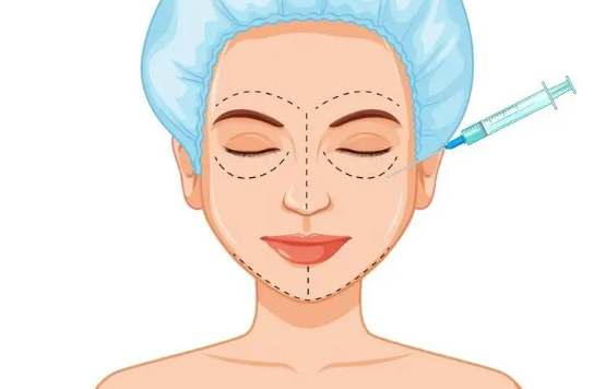 填充泪沟注射玻尿酸安全吗?