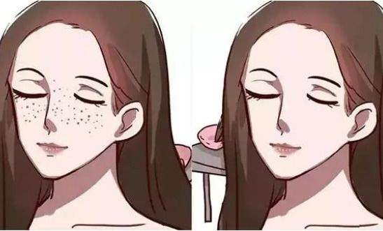 脸上的色斑怎么去掉 ？做哪些医疗项目可以去除？