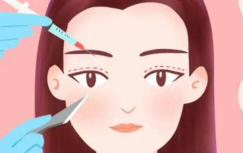 哪些因素影响双眼皮修复的价格