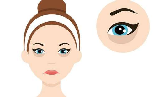 光电祛黑眼圈，告别熊猫眼，快速有效!