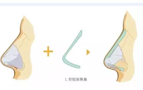 浙江医院整形美容科室介绍：隆鼻、自体脂肪移植等项目做得一级棒
