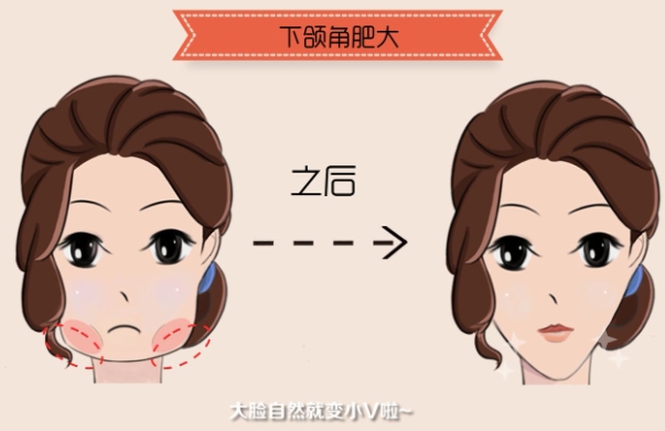 2024贵阳利美康整形医院收费参考表曝光：眼鼻、拉皮、隆胸等热门项目收费一键查询