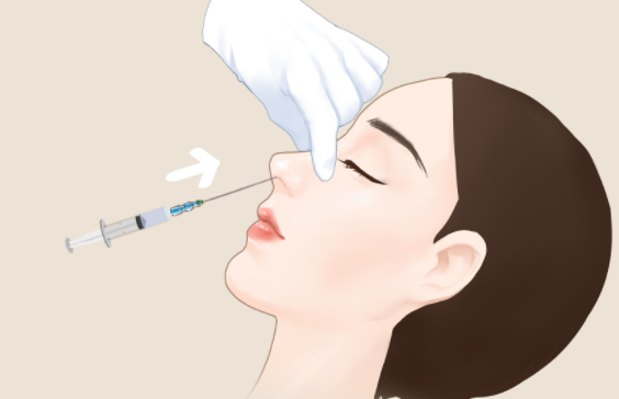 探索玻尿酸隆鼻：一针至三针的微妙艺术