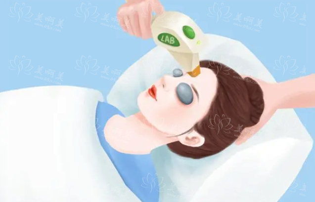 敏感性皮肤适合做光子嫩肤吗？