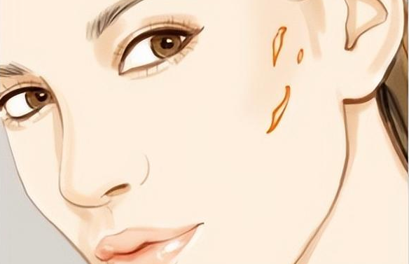 有效消除面部疤痕：科学方法与日常护理指南