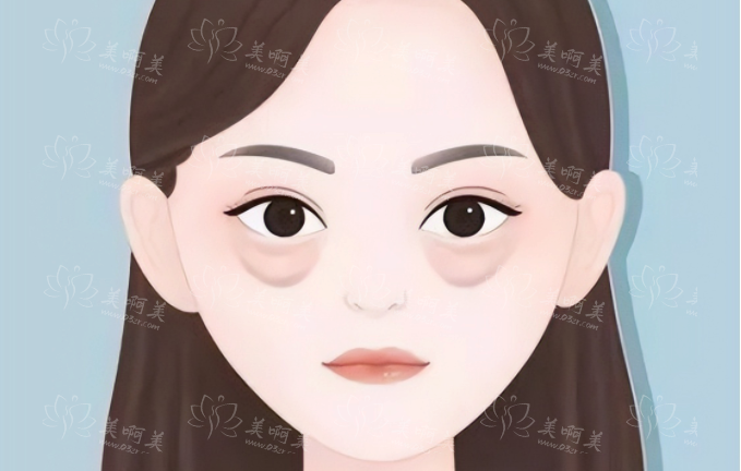 做眼袋手术后出现泪沟怎么办? 做眼袋手术后出现泪沟怎么办?