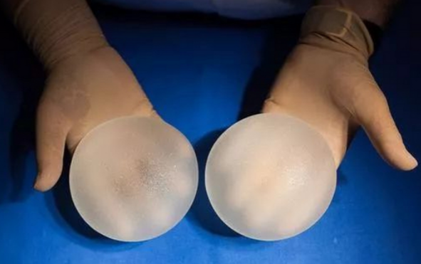 假体隆胸手术后异物感探究：真实体验与科学解析