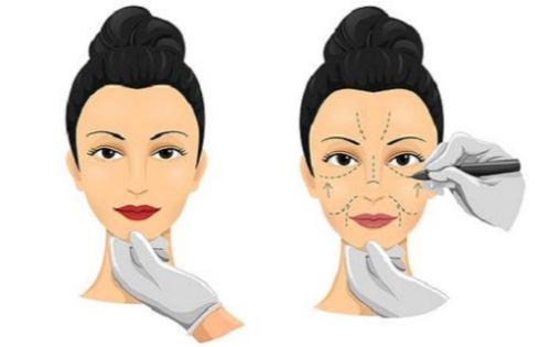 南方医科大学南方医院整形科室值得信赖吗?专业靠谱,口碑在线! 南方医科大学南方医院整形科室值得信赖吗?专业靠谱,口碑在线!