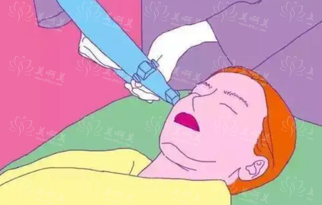 激光嫩肤：效果与优缺点解析