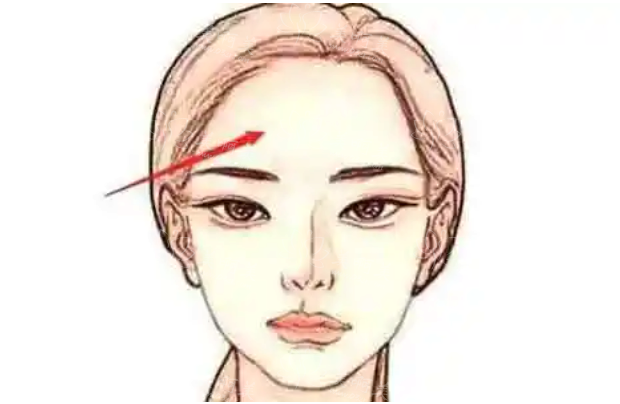 注射额头自体脂肪的优缺点分析
