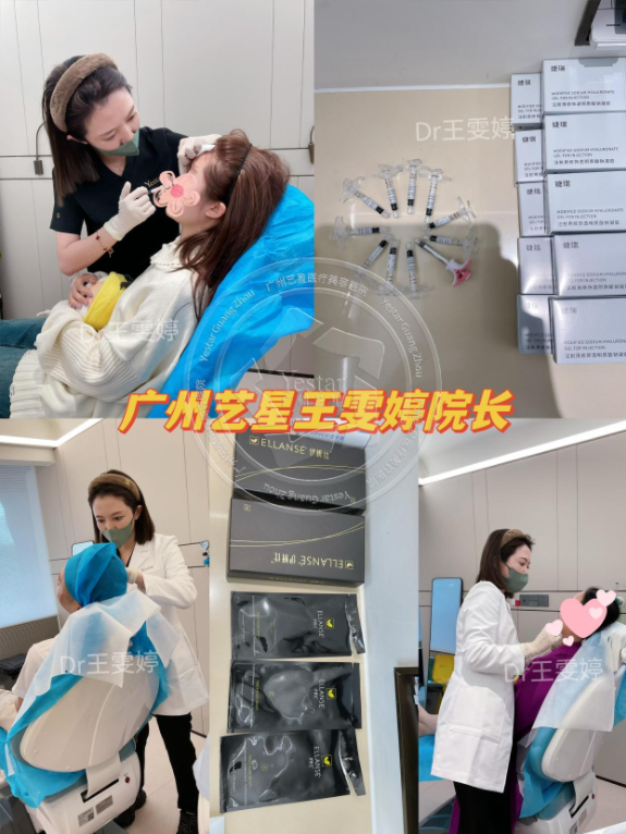 解码防馒化脸美学奥秘，广州艺星王雯婷打造完美年轻面庞