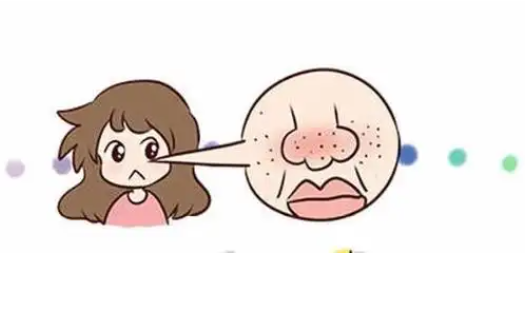 酒糟鼻：成因与调节方法