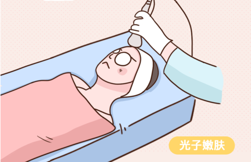 光子嫩肤的原理及调节过程