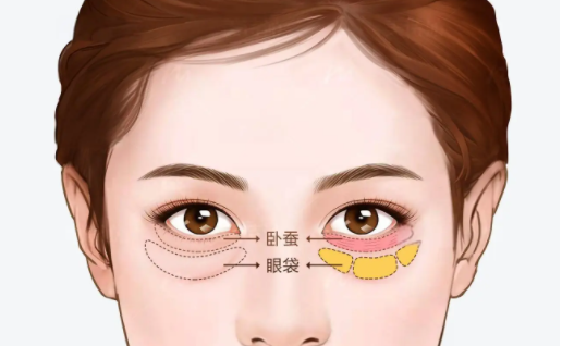 眼袋凹陷怎么恢复？这些方法可以尝试