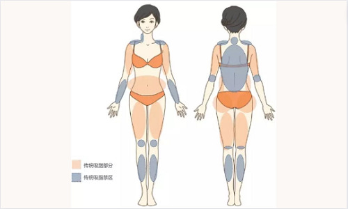 北京哪些整形医生吸脂技术好？实力医生资料简介！