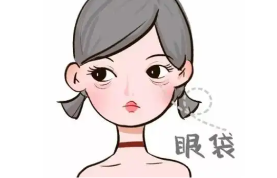 去除眼袋内脂肪后是否会再次出现？