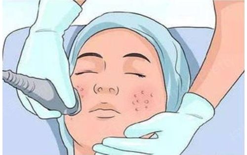 中山三院点阵激光做得怎么样？医院科室简介+项目收费参考！