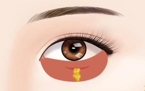 切眼袋手术是否存在潜在的风险和危险？