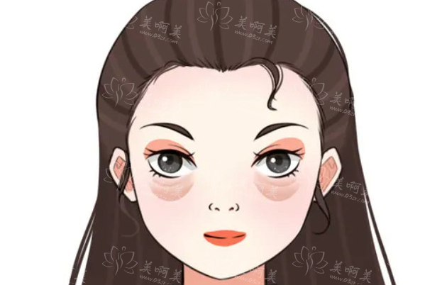 去除眼袋内脂肪后，还会 “卷土重来” 吗？