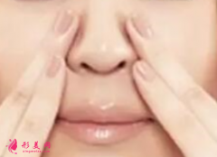 鼻翼缩小手术前要注意什么?