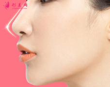 假体隆鼻后要怎么消肿？