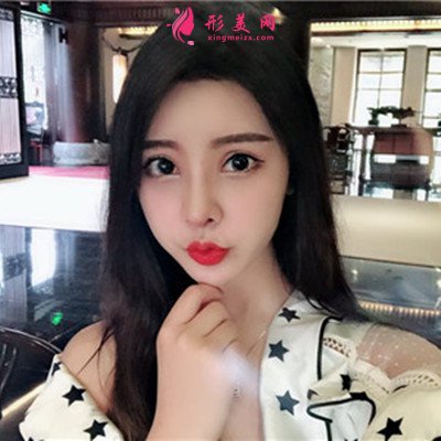 郑州鼻综合术后恢复效果对比