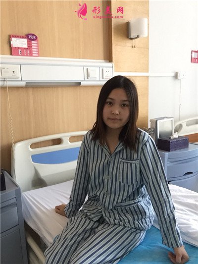 郑州膨体隆鼻术后恢复情况对比