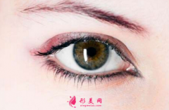 做开眼角手术什么时候能恢复？
