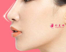 假体隆鼻后还可以取出吗？