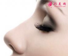 自体肋软骨隆鼻什么时候拆线？