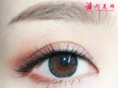做开眼角的注意事项