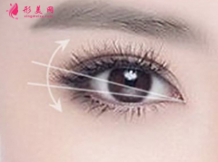 开眼角会有风险吗？