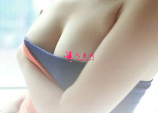 假体隆胸术后的护理事项