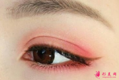 全切双眼皮手术有哪些风险？